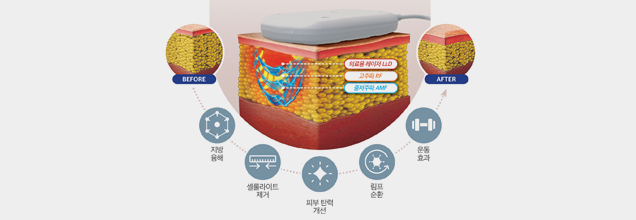 쉬리안 노플쉐이프